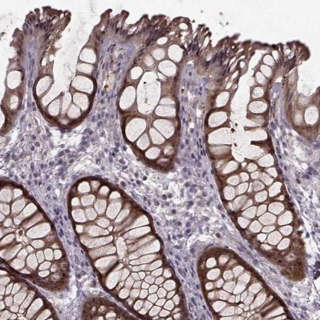 GSS Antibody in Immunohistochemistry (IHC)