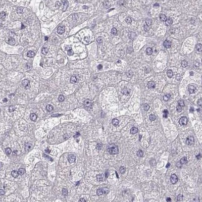 GRK1 Antibody in Immunohistochemistry (IHC)