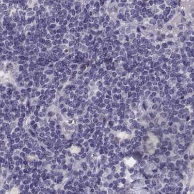 GRK1 Antibody in Immunohistochemistry (IHC)