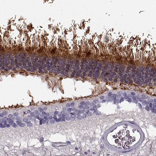 GRK1 Antibody in Immunohistochemistry (IHC)