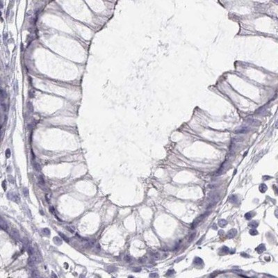 GRK1 Antibody in Immunohistochemistry (IHC)