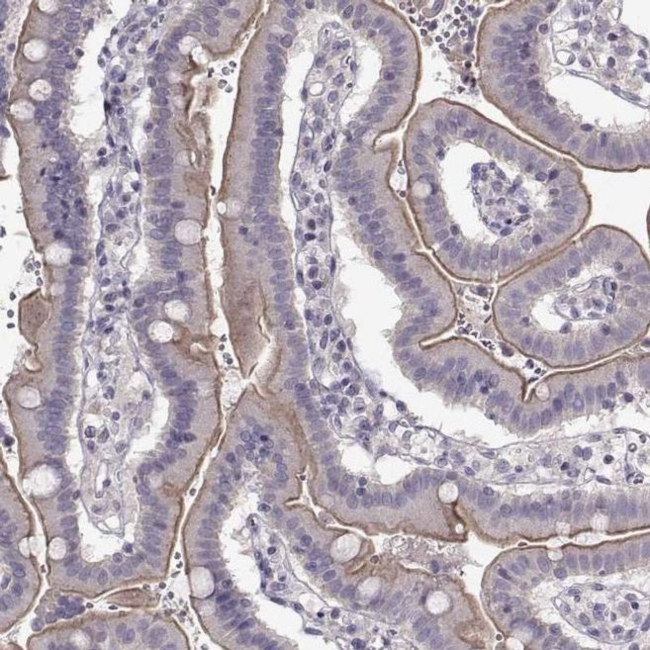 GRK1 Antibody in Immunohistochemistry (IHC)