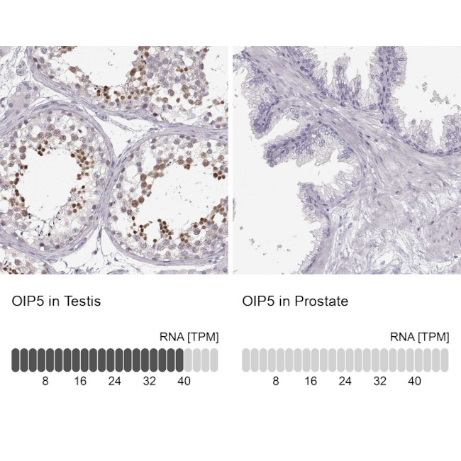 OIP5 Antibody in Immunohistochemistry (IHC)