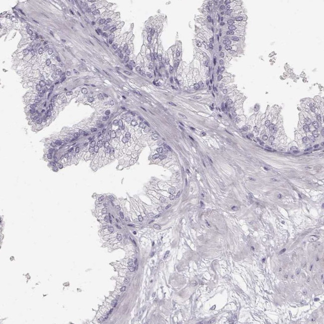 OIP5 Antibody in Immunohistochemistry (IHC)