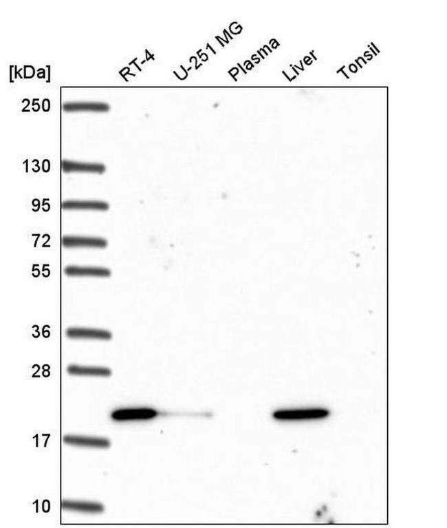 OIP5 Antibody in Western Blot (WB)