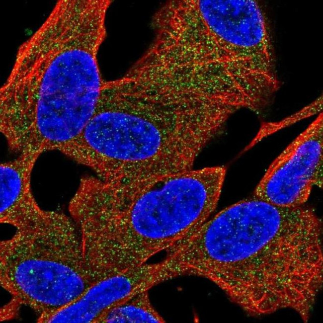 PDE6B Antibody in Immunocytochemistry (ICC/IF)