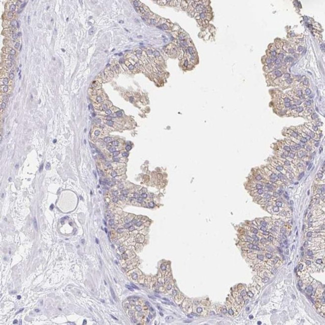 PDE6B Antibody in Immunohistochemistry (IHC)