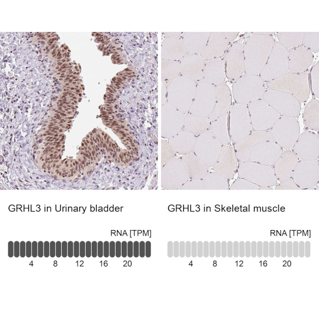 GRHL3 Antibody in Immunohistochemistry (IHC)