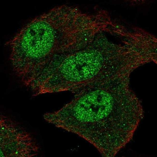 SMOX Antibody in Immunocytochemistry (ICC/IF)