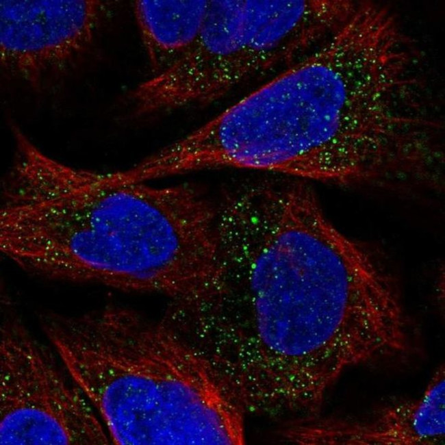 ESPN Antibody in Immunocytochemistry (ICC/IF)