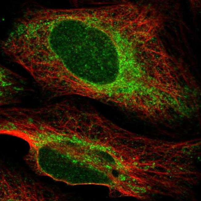 PTPLAD1 Antibody in Immunocytochemistry (ICC/IF)