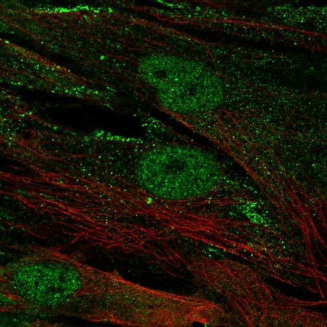 CENPJ Antibody in Immunocytochemistry (ICC/IF)