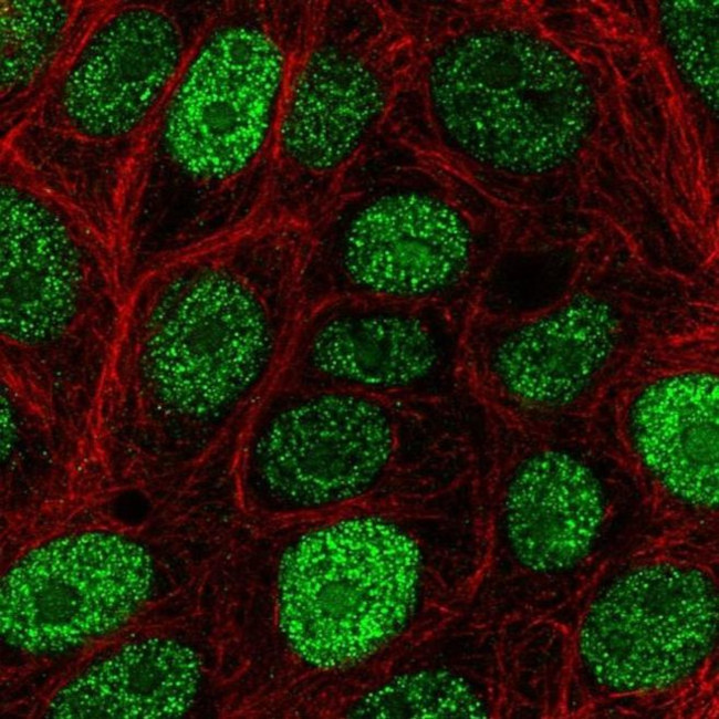 CIRBP Antibody in Immunocytochemistry (ICC/IF)