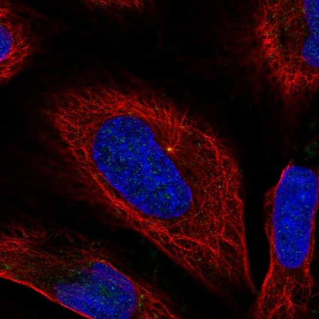 C17orf59 Antibody in Immunocytochemistry (ICC/IF)