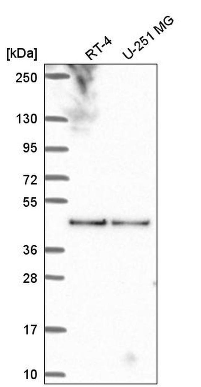 C17orf59 Antibody in Western Blot (WB)