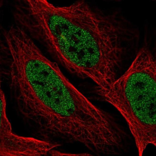 YDJC Antibody in Immunocytochemistry (ICC/IF)