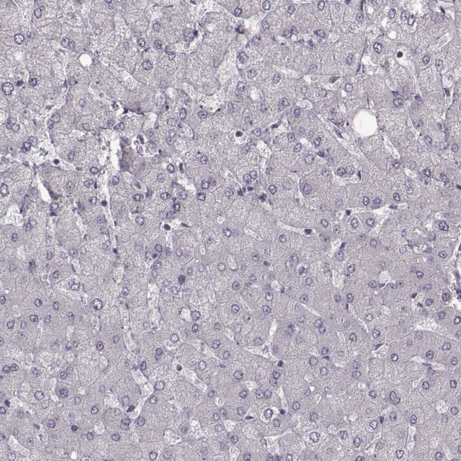 CCDC64 Antibody in Immunohistochemistry (IHC)