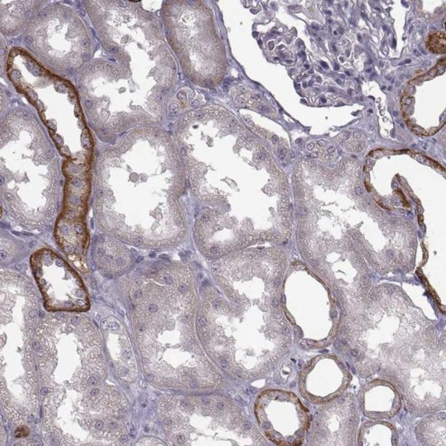 CCDC64 Antibody in Immunohistochemistry (IHC)