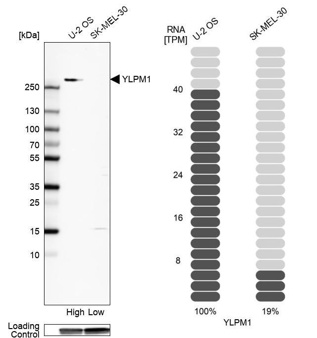 YLPM1 Antibody