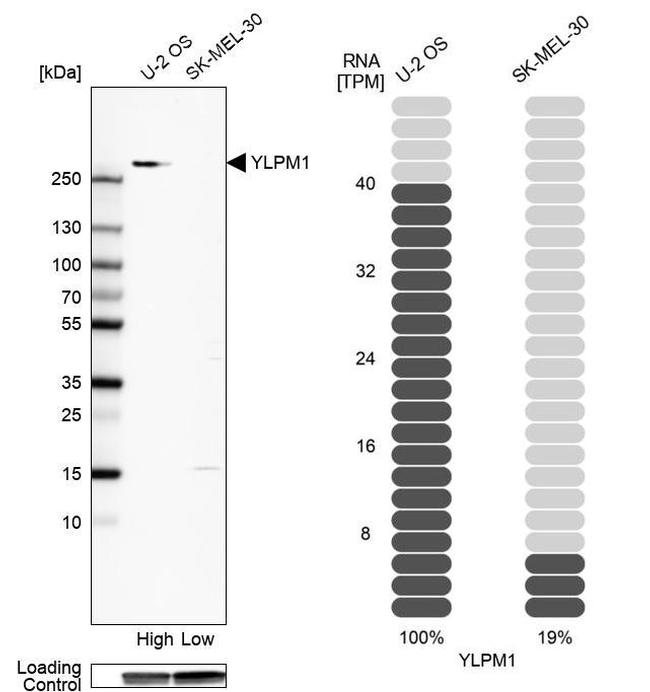 YLPM1 Antibody in Western Blot (WB)