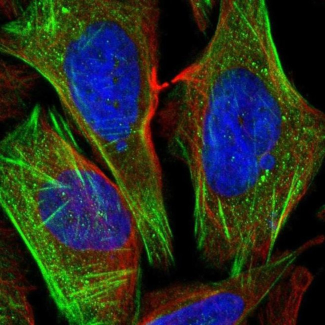 CSGALNACT1 Antibody in Immunocytochemistry (ICC/IF)