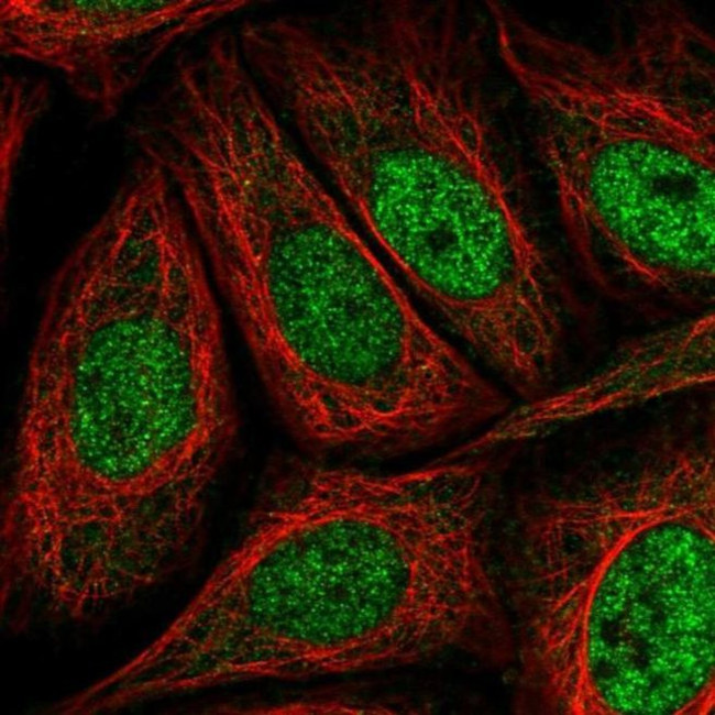 AKIP1 Antibody in Immunocytochemistry (ICC/IF)