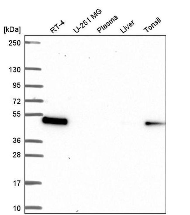 LPXN Antibody in Western Blot (WB)