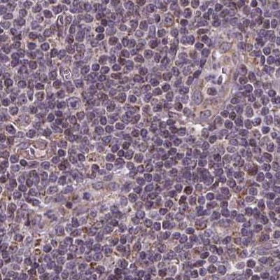 SUCLA2 Antibody in Immunohistochemistry (IHC)