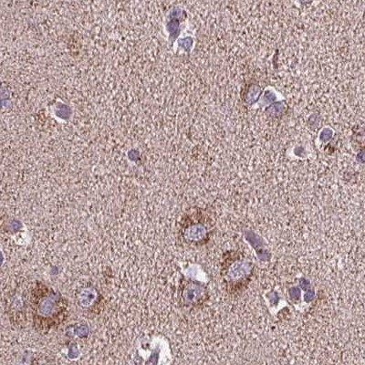 SUCLA2 Antibody in Immunohistochemistry (IHC)