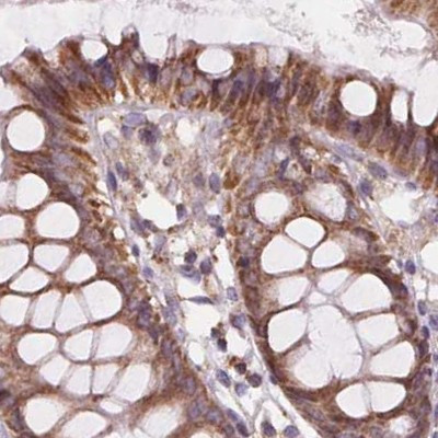 SUCLA2 Antibody in Immunohistochemistry (IHC)