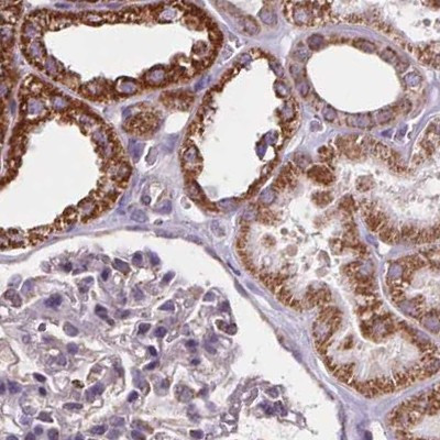 SUCLA2 Antibody in Immunohistochemistry (IHC)