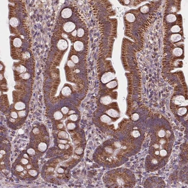 SUCLA2 Antibody in Immunohistochemistry (IHC)