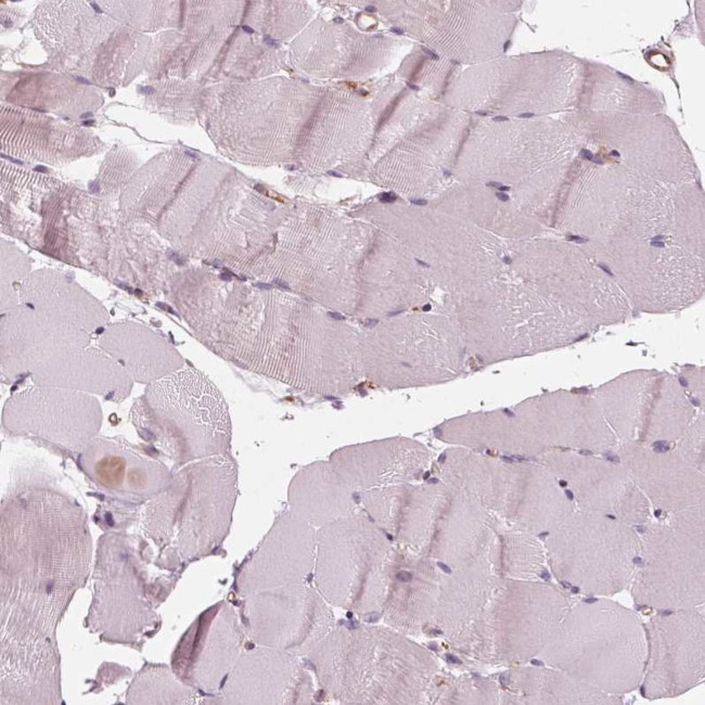 IKBIP Antibody in Immunohistochemistry (IHC)