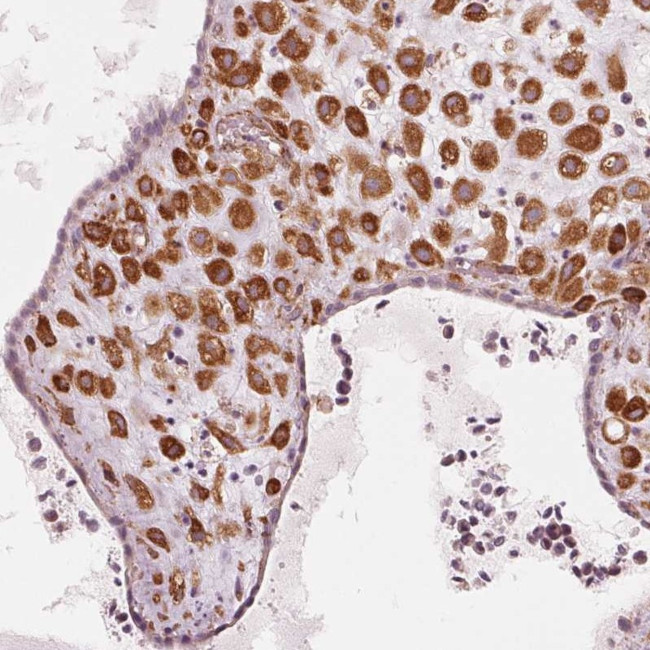 IKBIP Antibody in Immunohistochemistry (IHC)