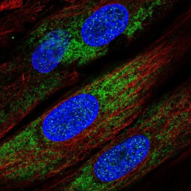 IKBIP Antibody in Immunocytochemistry (ICC/IF)