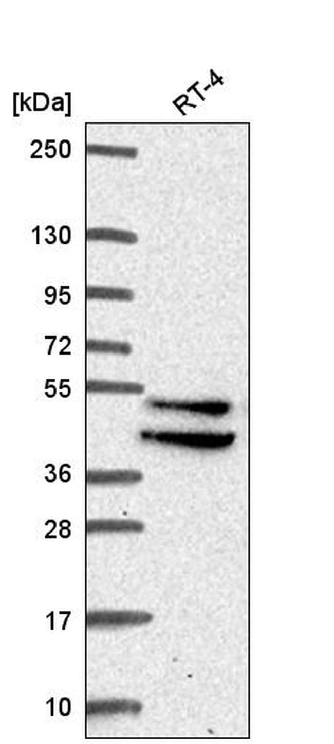 IKBIP Antibody in Western Blot (WB)