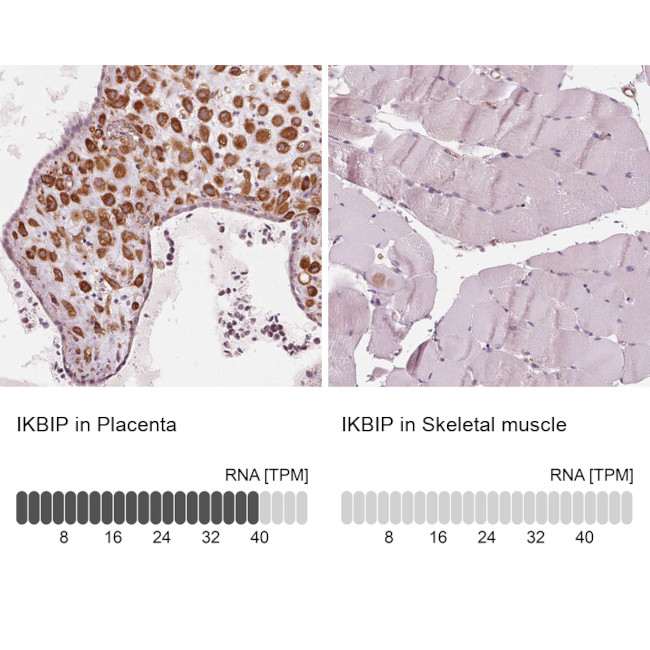 IKBIP Antibody