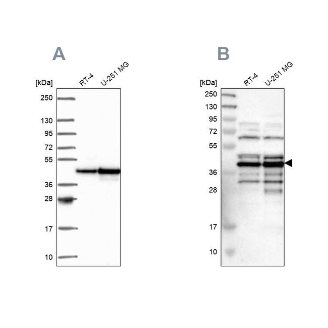 SLBP Antibody in Western Blot (WB)