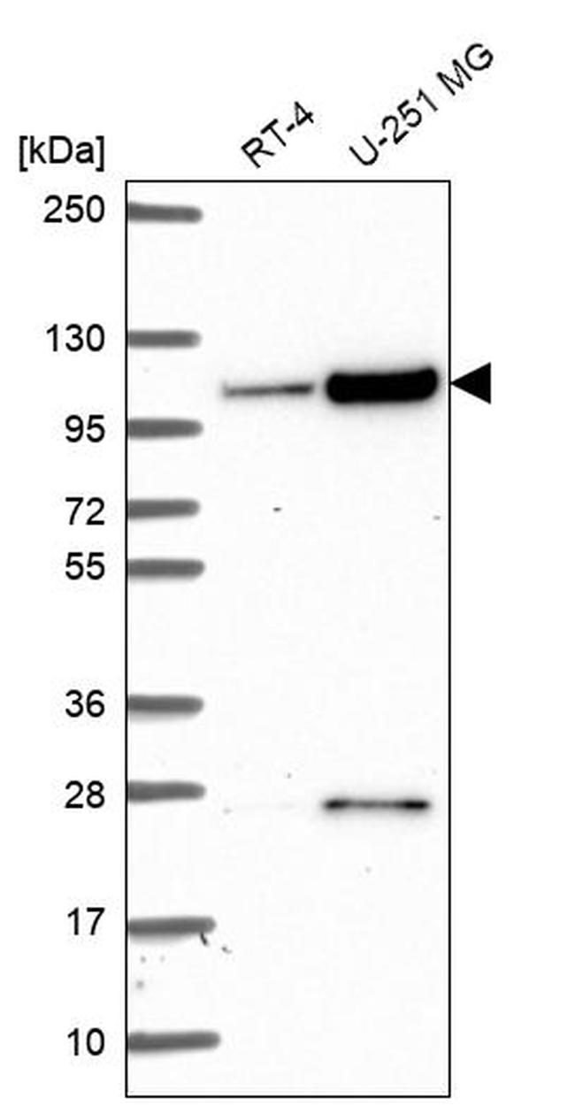 KIAA1614 Antibody in Western Blot (WB)