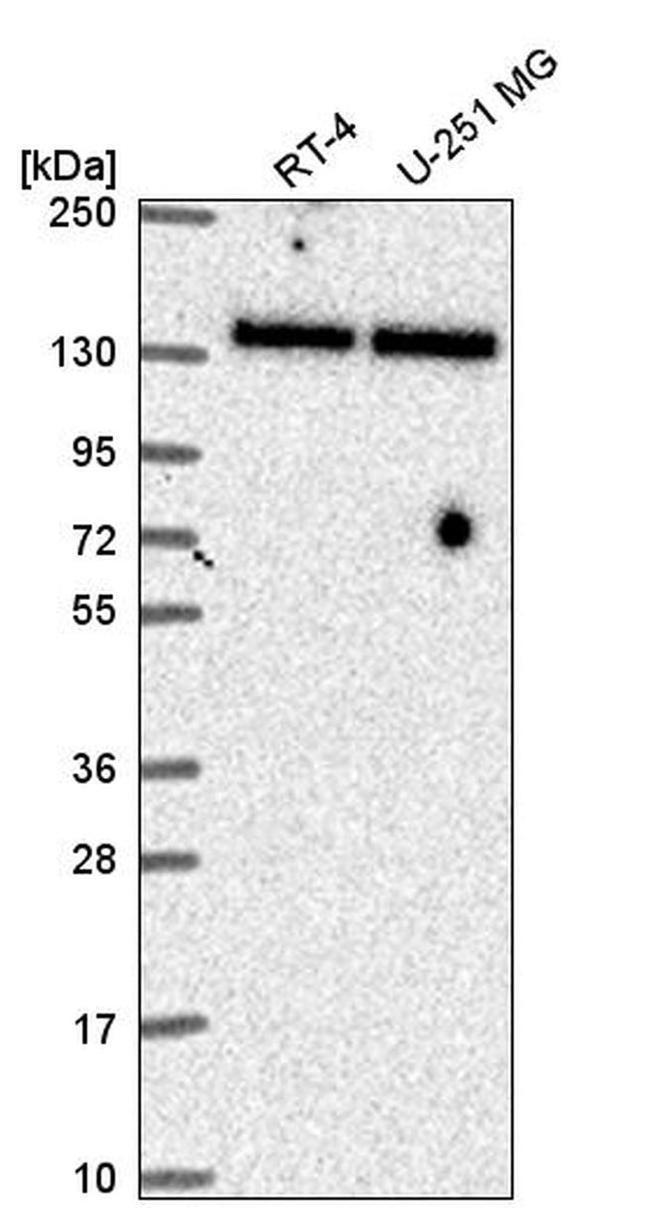 TRIM24 Antibody in Western Blot (WB)