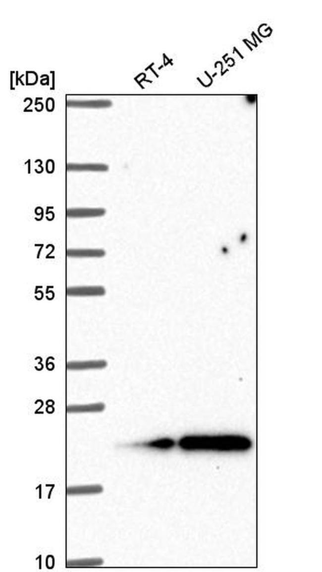 KIAA1143 Antibody in Western Blot (WB)