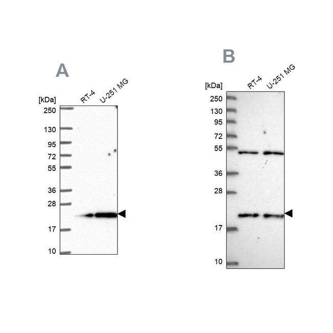 KIAA1143 Antibody in Western Blot (WB)