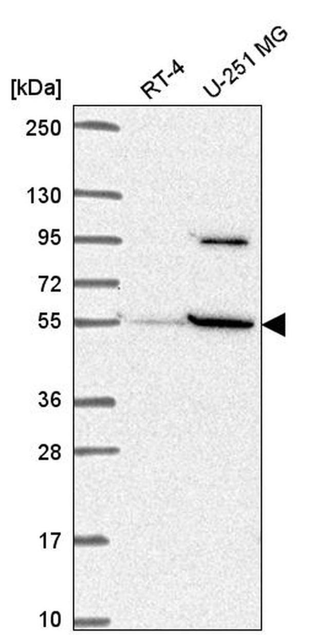 SLC37A3 Antibody in Western Blot (WB)