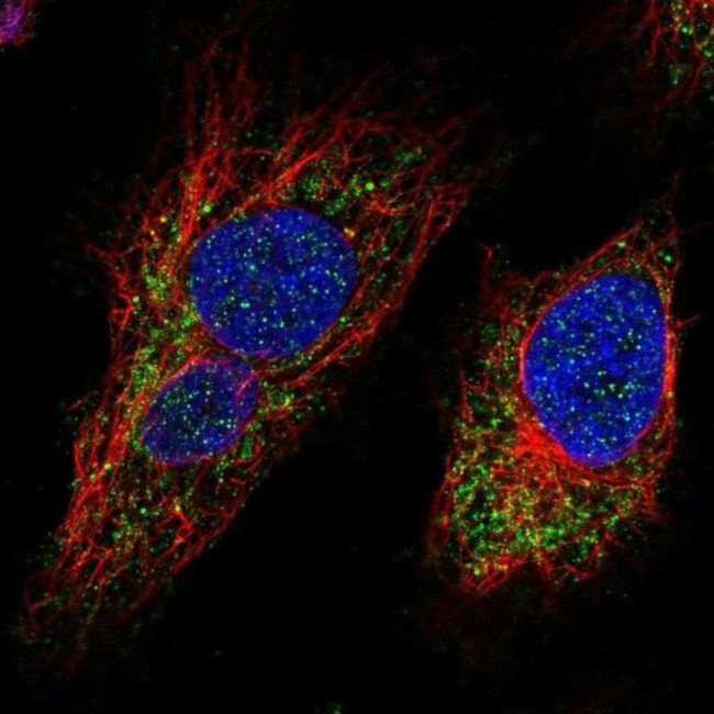 MTX3 Antibody in Immunocytochemistry (ICC/IF)