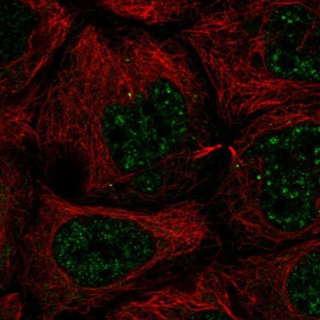 SLC35A4 Antibody in Immunocytochemistry (ICC/IF)