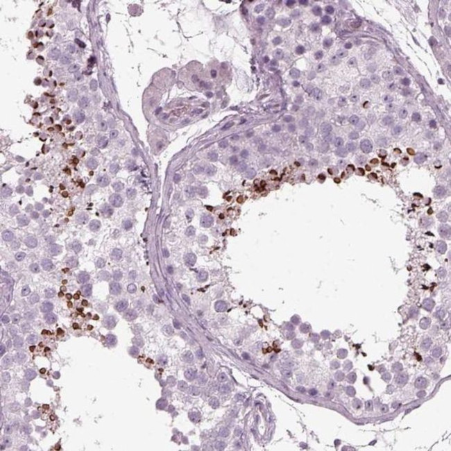 PDC Antibody in Immunohistochemistry (IHC)