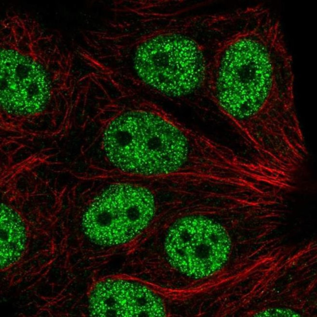 ABI2 Antibody in Immunocytochemistry (ICC/IF)