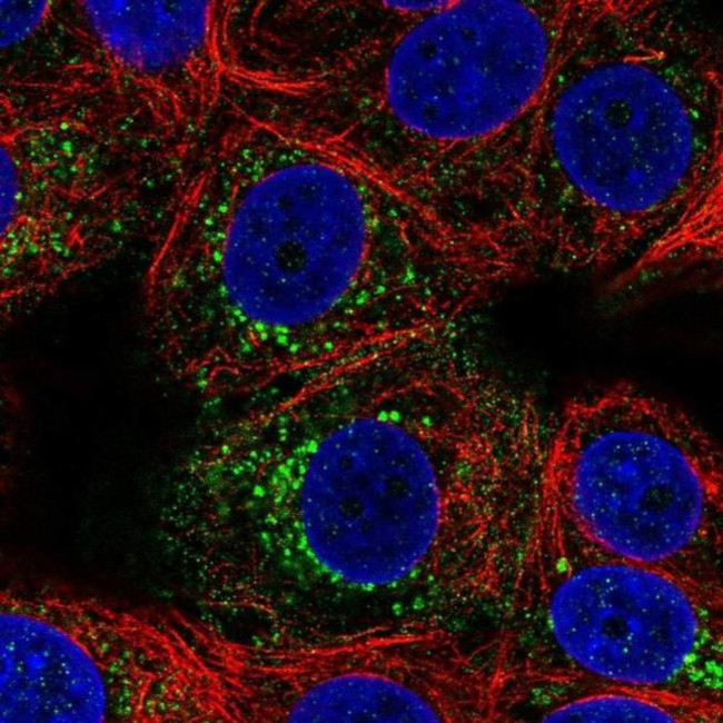 ACBD7 Antibody in Immunocytochemistry (ICC/IF)