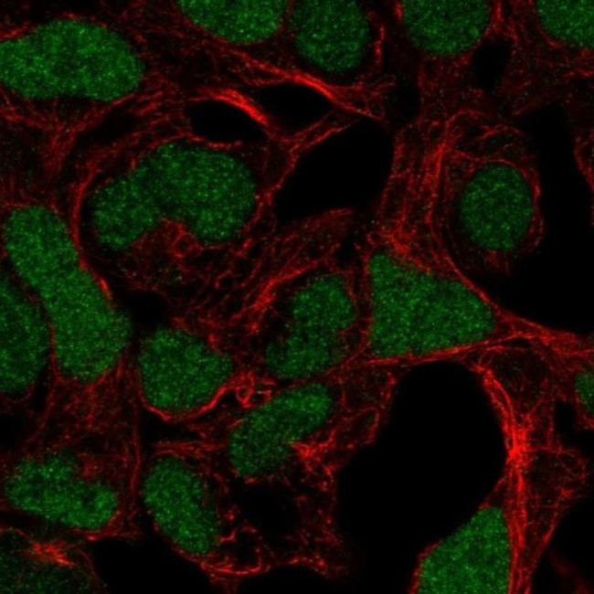 ADAMTS17 Antibody in Immunocytochemistry (ICC/IF)