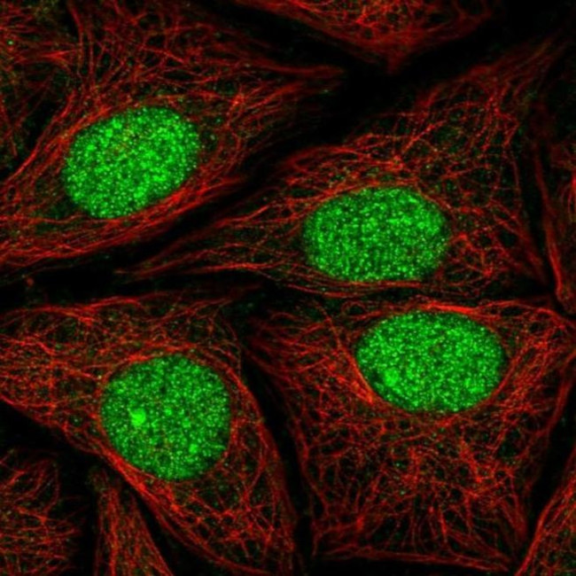 ATXN1L Antibody in Immunocytochemistry (ICC/IF)